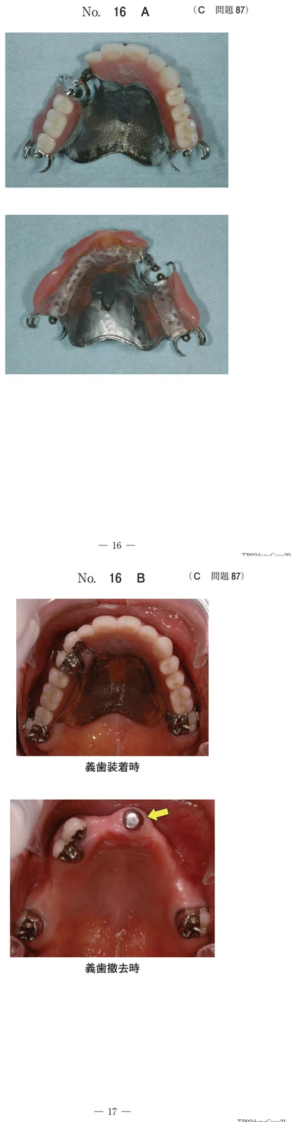 108C87 別冊画像