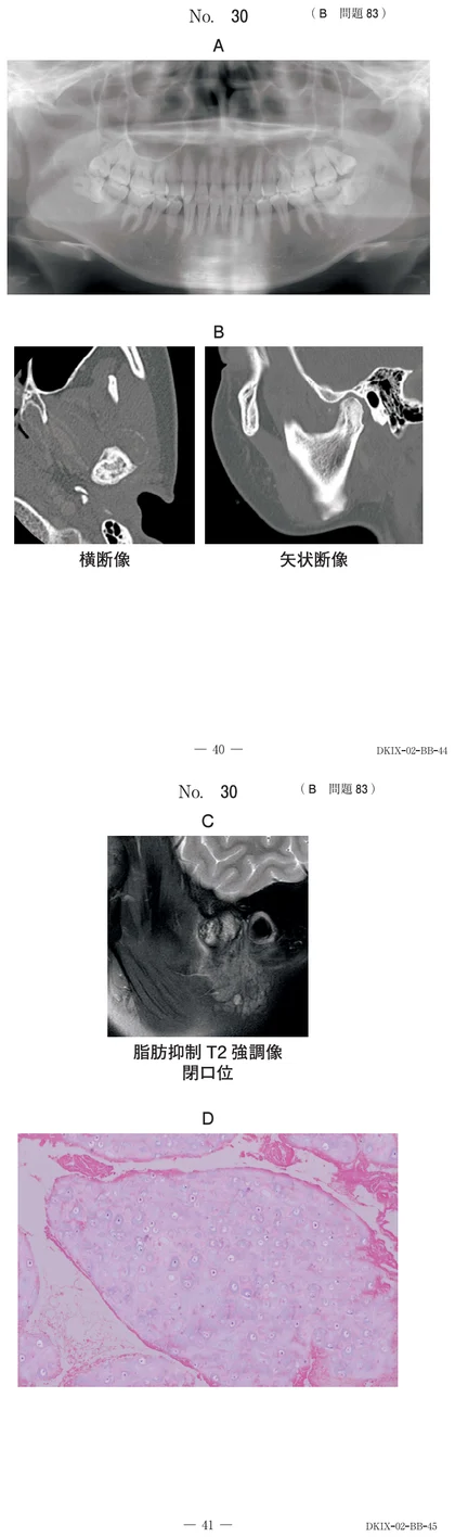 117B83 別冊画像