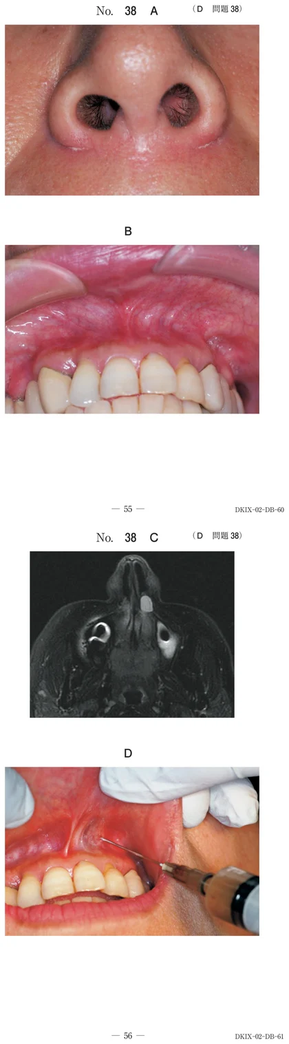 106D38 別冊画像