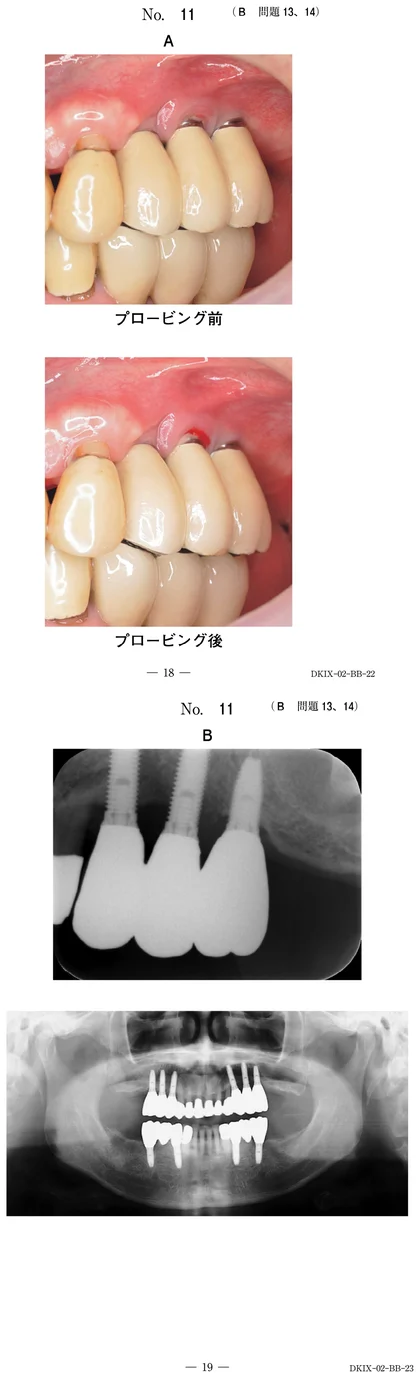 110B13 別冊画像