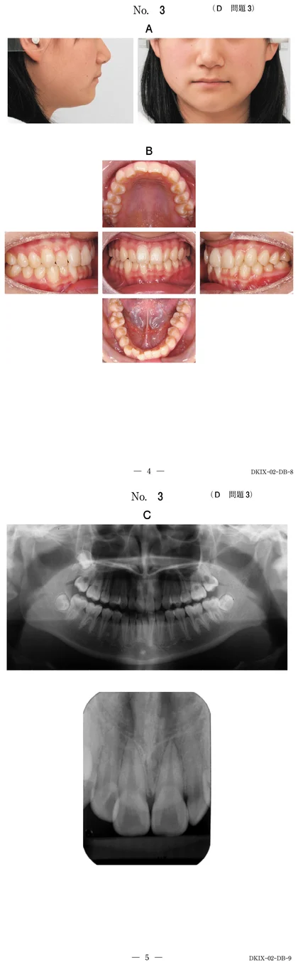 110D3 別冊画像