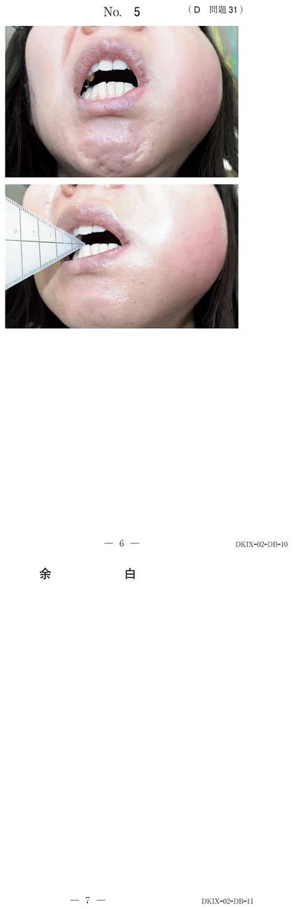117D31 別冊画像