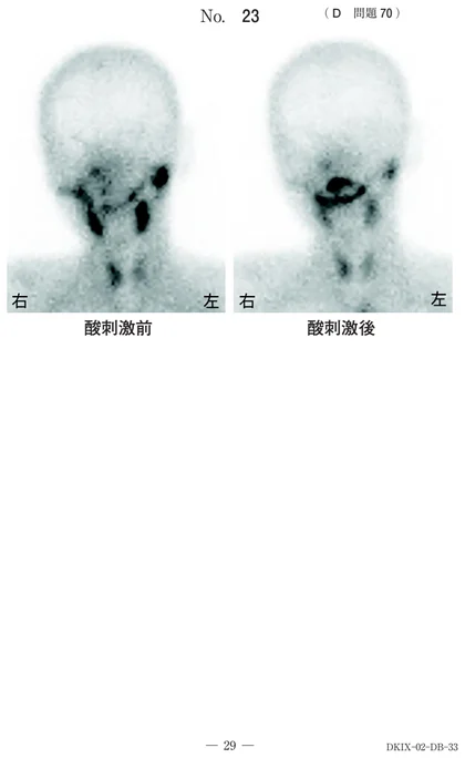 113D70 別冊画像