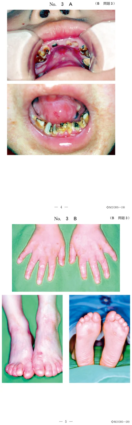 104B3 別冊画像