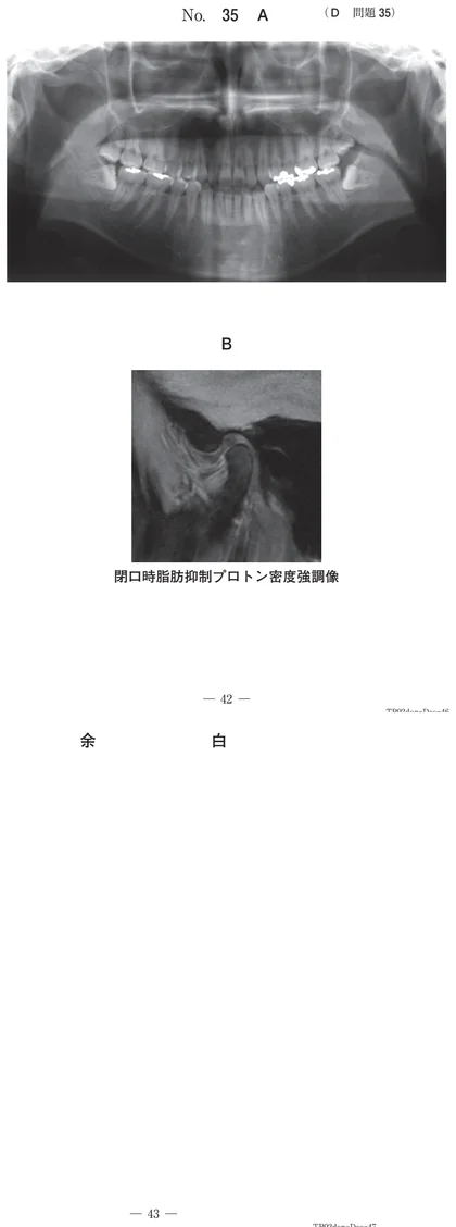 108D35 別冊画像
