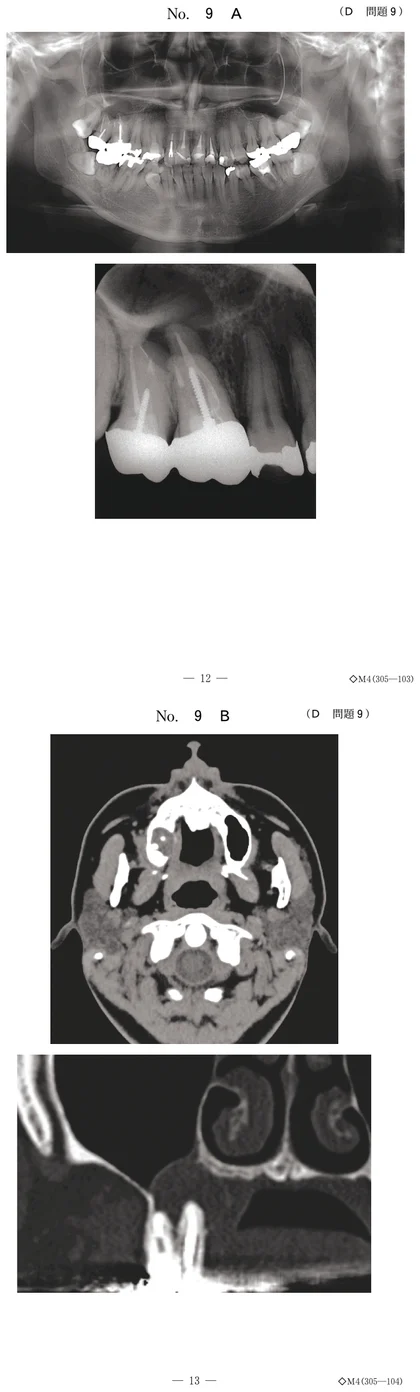 104D9 別冊画像