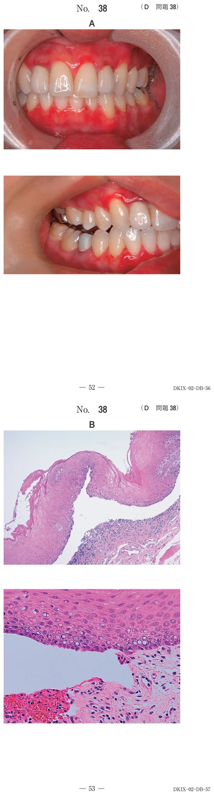 109D38 別冊画像