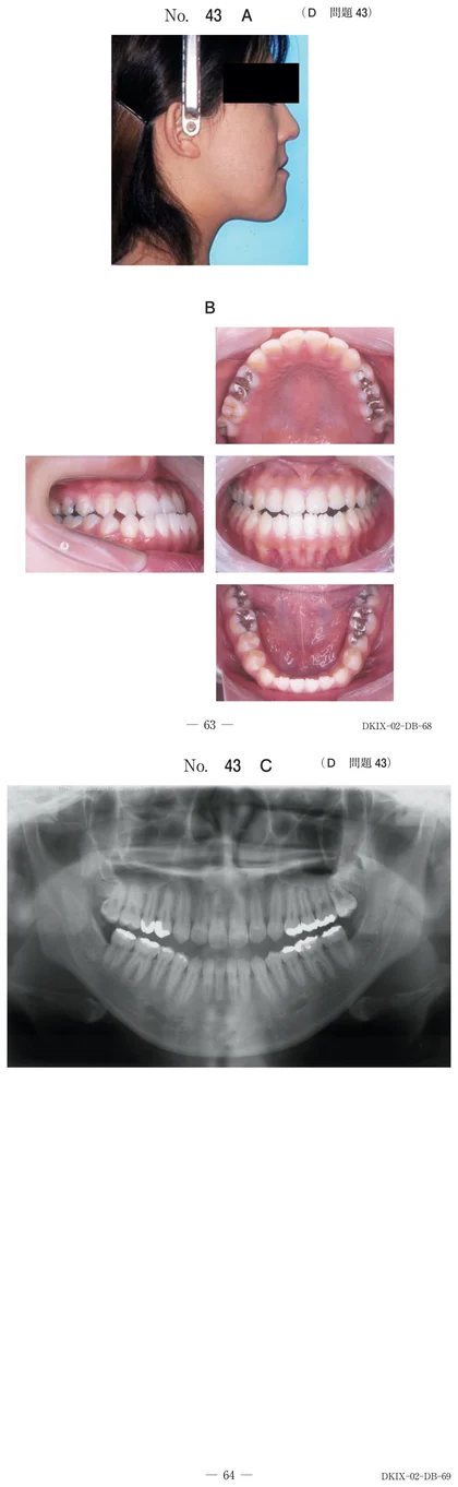 106D43 別冊画像