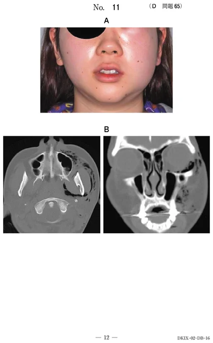 111D65 別冊画像
