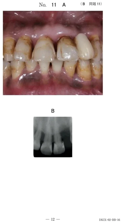 105B11 別冊画像