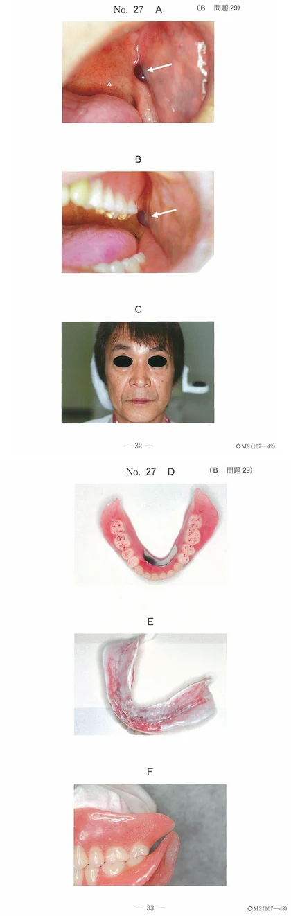 103B29 別冊画像