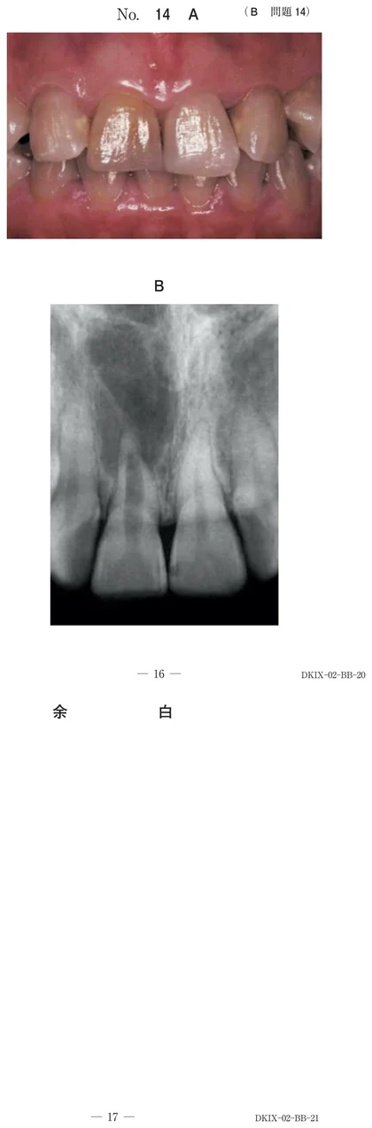 106B14 別冊画像