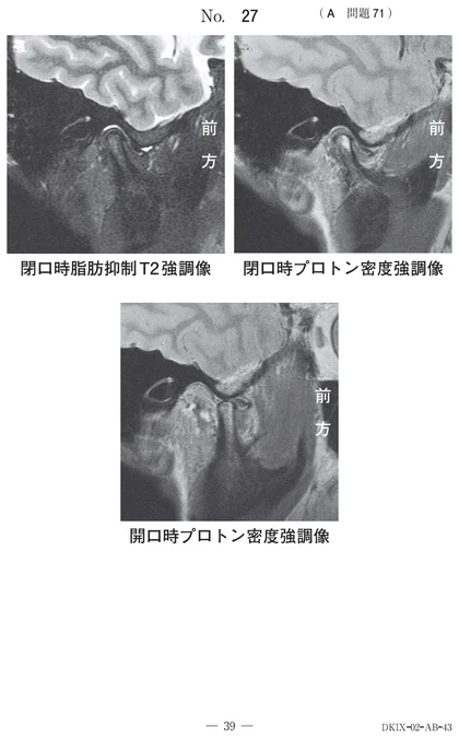 115A71 別冊画像