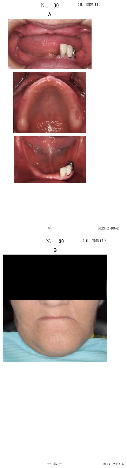 119B81 別冊画像