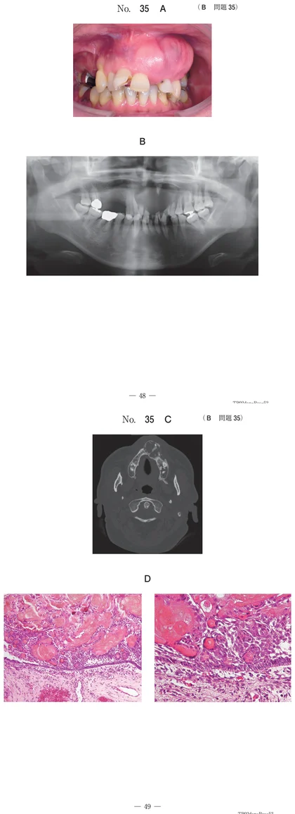 108B35 別冊画像