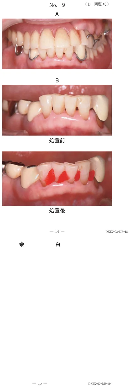 117D40 別冊画像