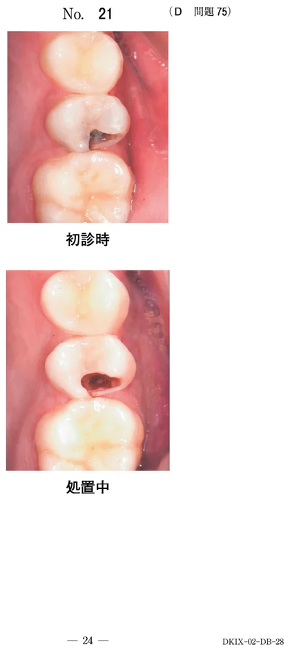 111D75 別冊画像