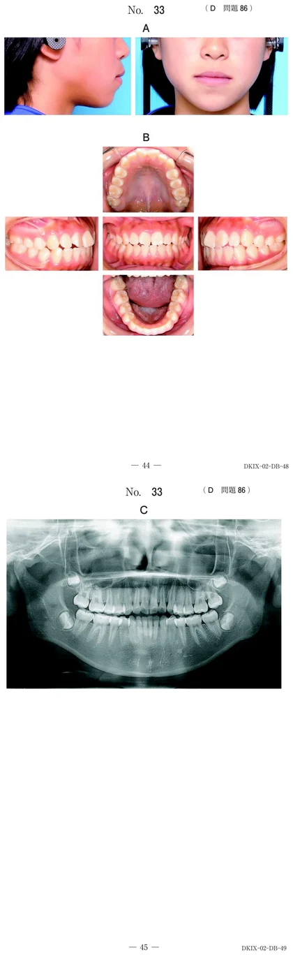 113D86 別冊画像