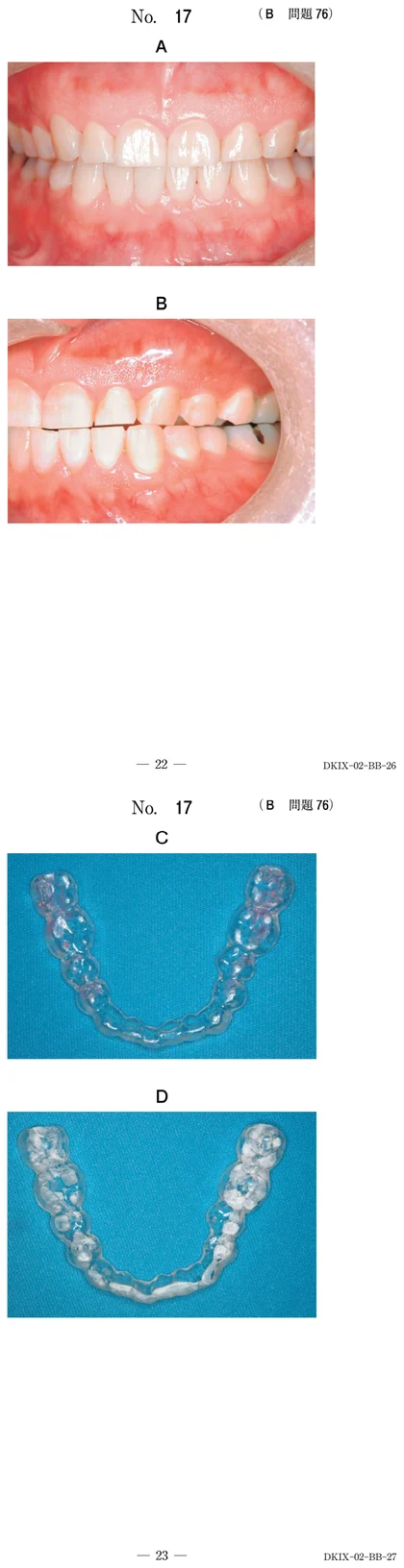 111B76 別冊画像