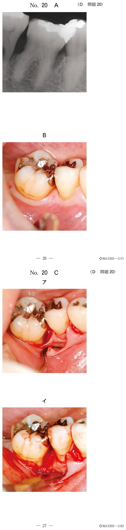 104D20 別冊画像