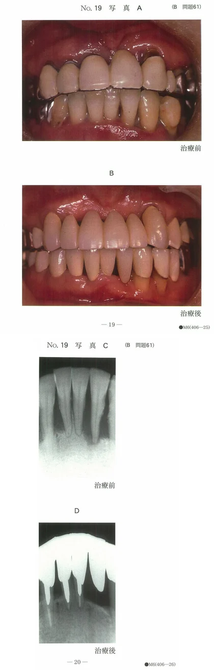 99B61 別冊画像