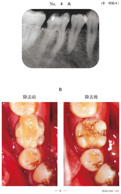 104B4 別冊画像
