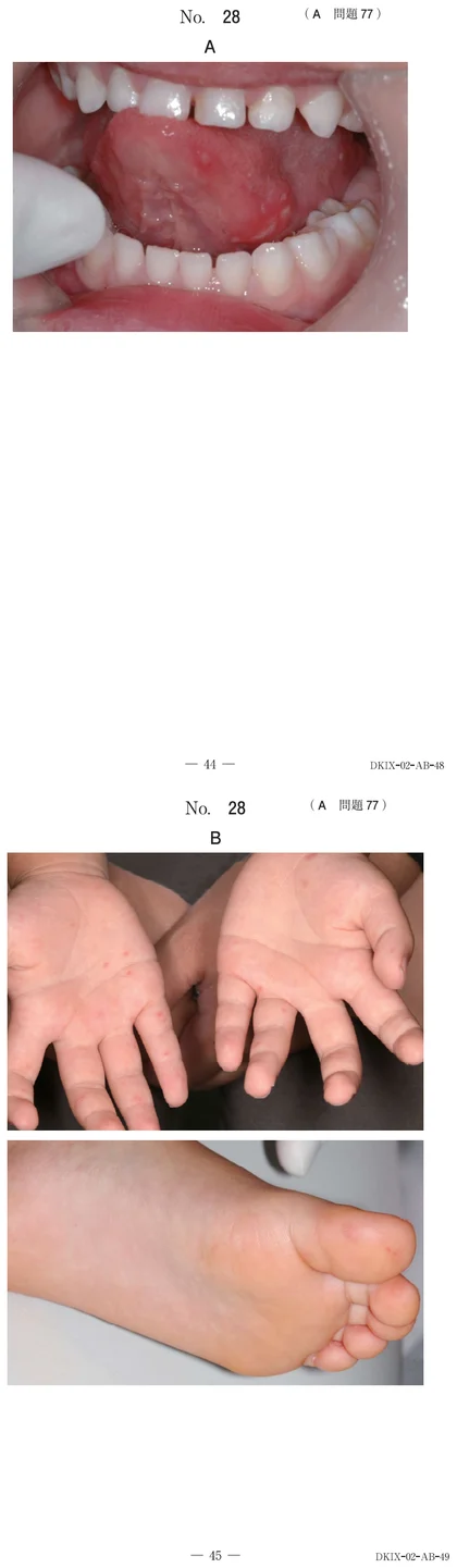 116A77 別冊画像