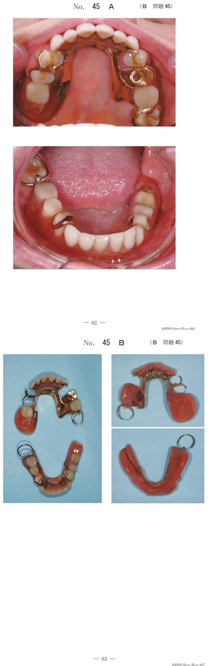 107B45 別冊画像