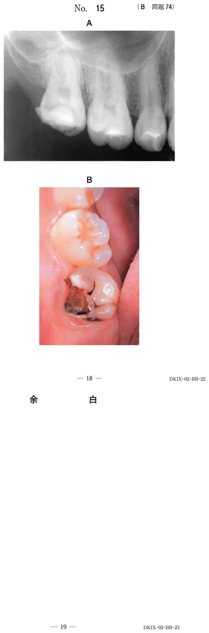 111B74 別冊画像
