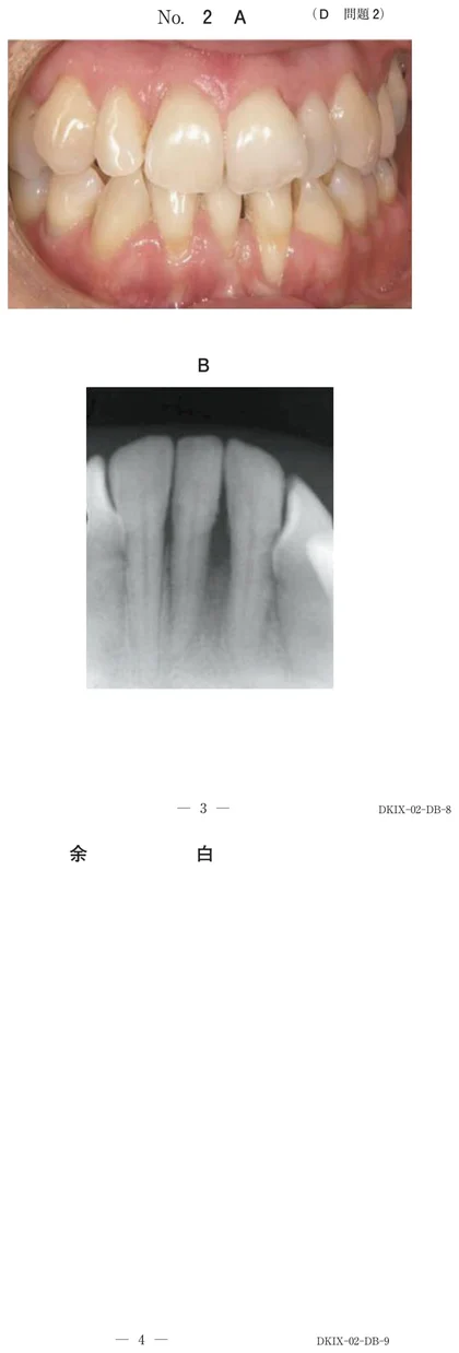 106D2 別冊画像