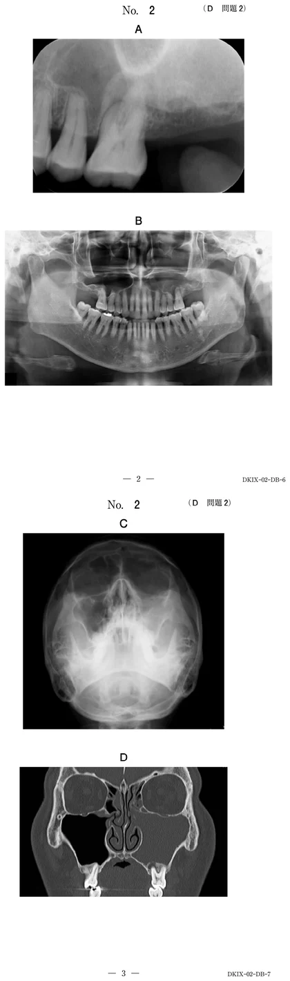 110D2 別冊画像