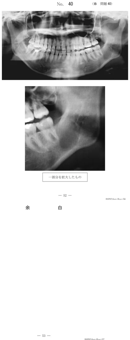 107B40 別冊画像