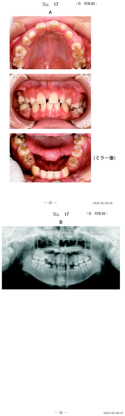 113D63 別冊画像