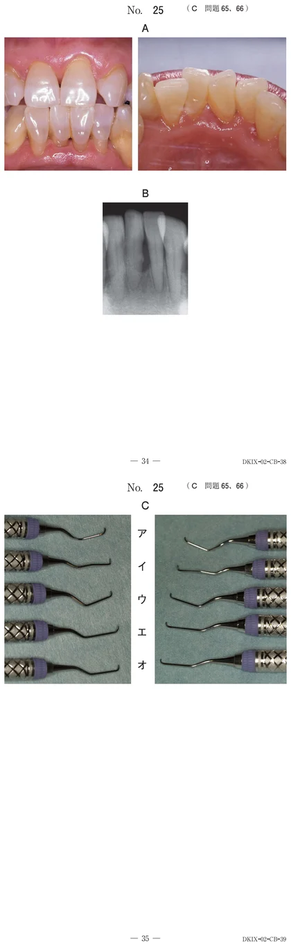 115C66 別冊画像