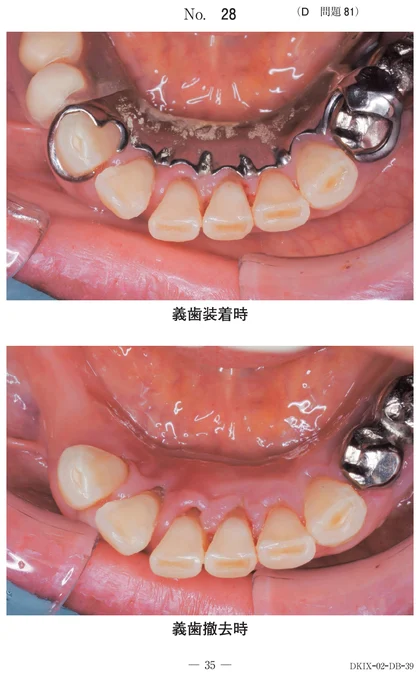 112D81 別冊画像