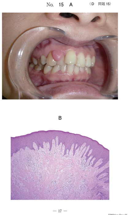 108D15 別冊画像
