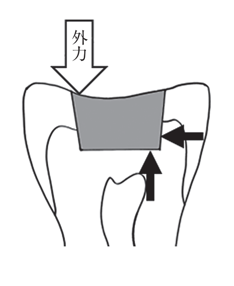 119D75 問題中の図