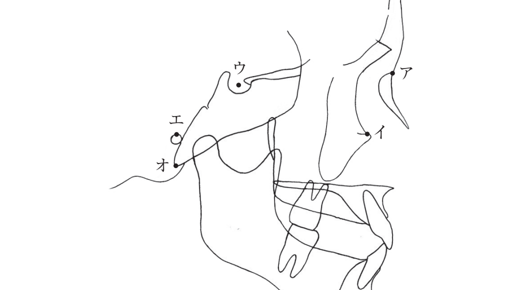 109C28 問題中の図