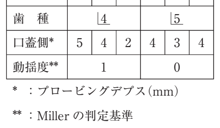 111A75 問題中の図