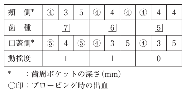 109B32 問題中の図
