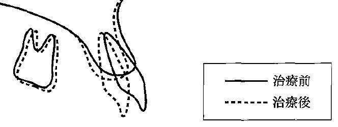 104D44 問題中の図