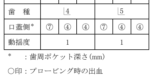 107B35 問題中の図