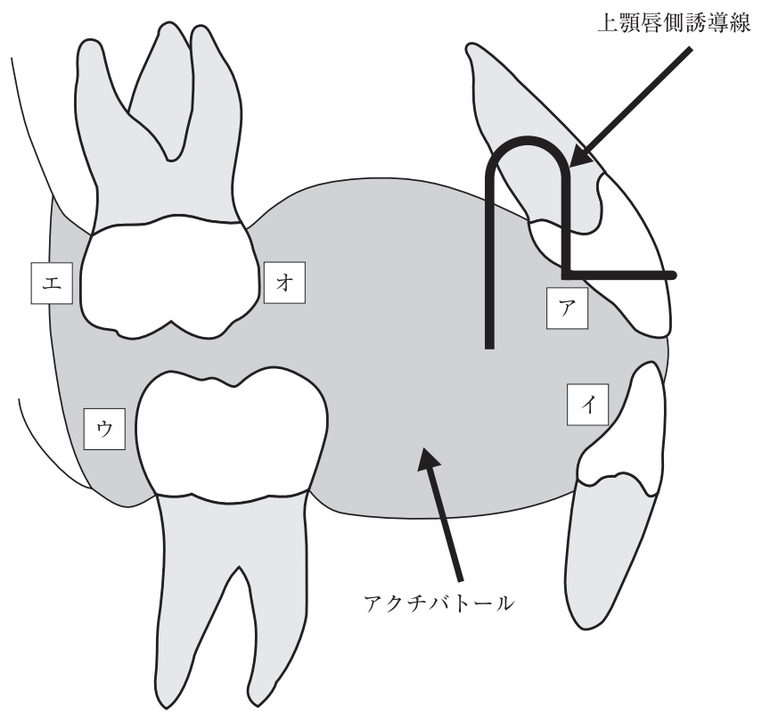 116D89 問題中の図