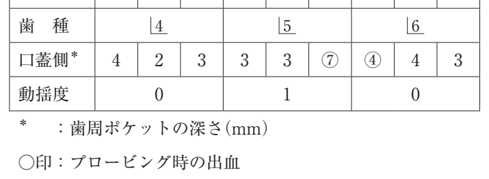 108B9 問題中の図