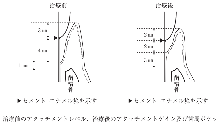106A95 問題中の図