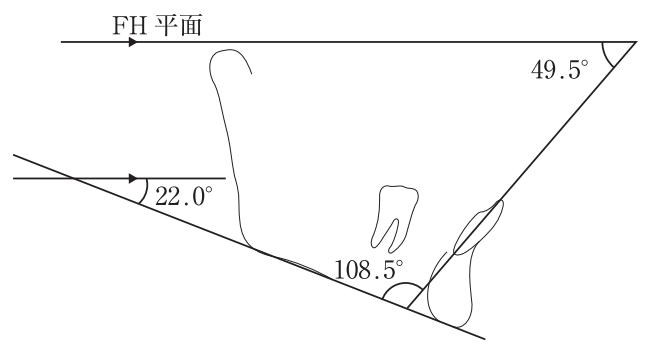 111C62 問題中の図