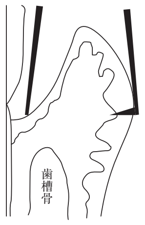 109A58 問題中の図