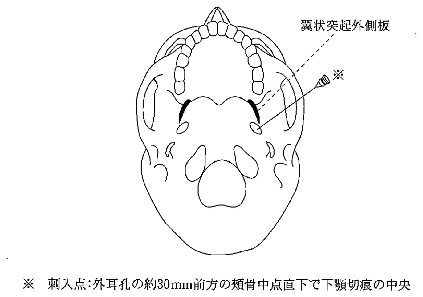 100D55 問題中の図