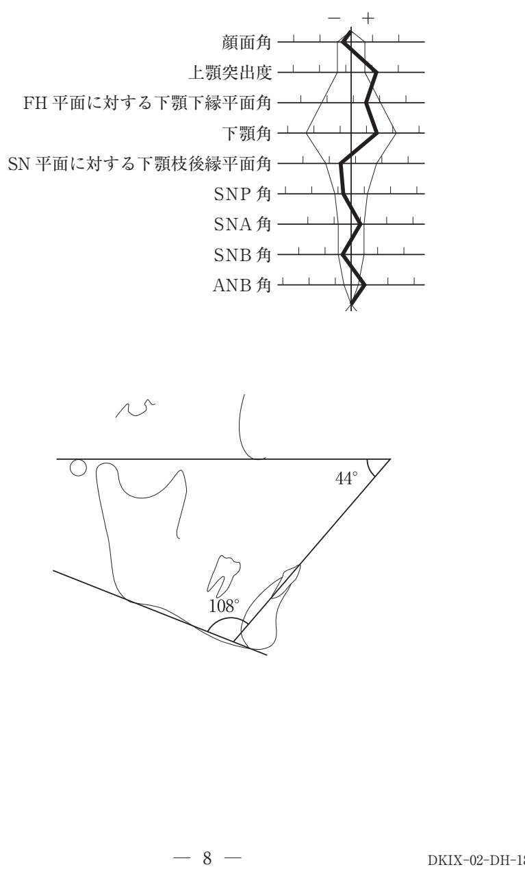 110D12 問題中の図