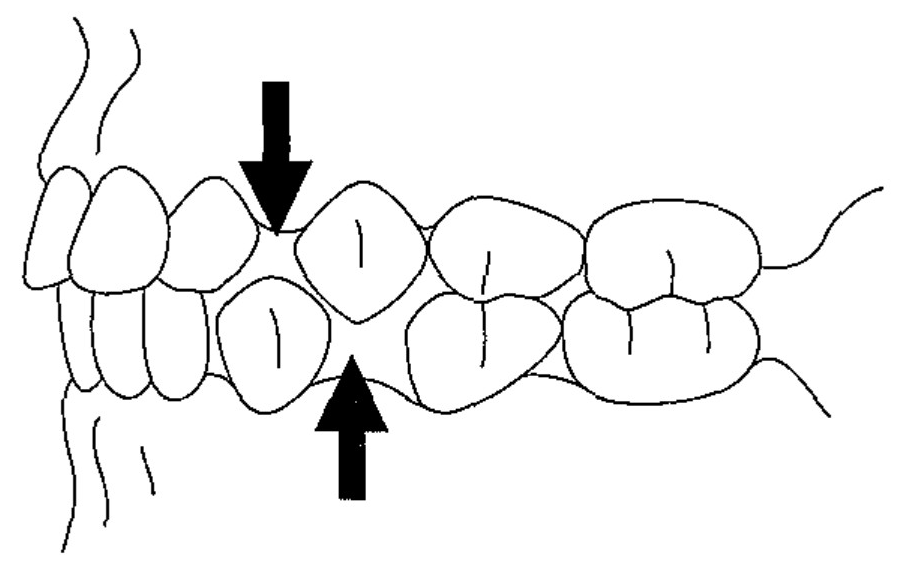 99B2 問題中の図